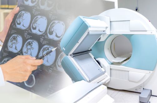 当院の特長イメージ:胆のう、胆管、膵臓疾患の専門医