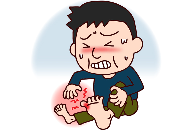 痛風（高尿酸血症）のイメージ