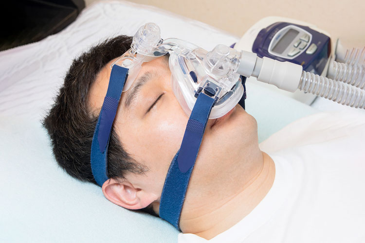 睡眠時無呼吸症候群の治療イメージ